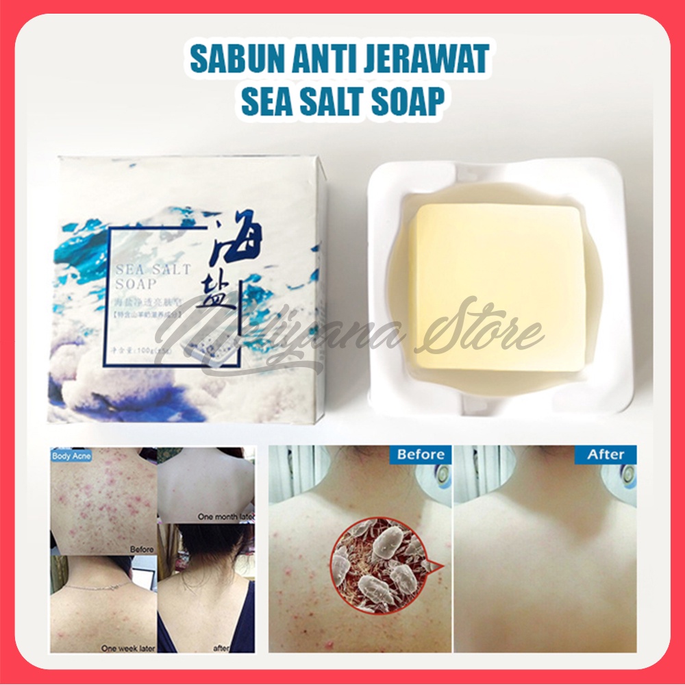 ORIGINAL Sabun Jerawat Sea Salt Menghilangkan Jerawat Punggung