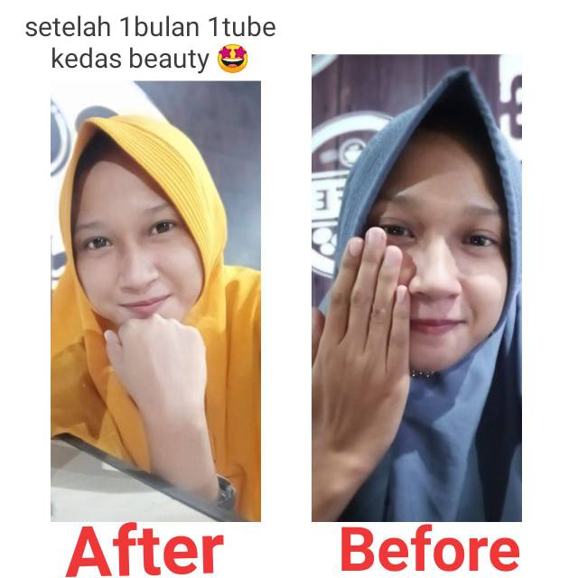 Kedasbeauty body serum-1