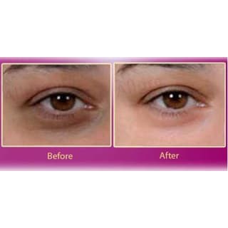 TERMURAH Dark Circle Cream    Cream perawatan Lingkaran Hitam kelopak Mata Murah