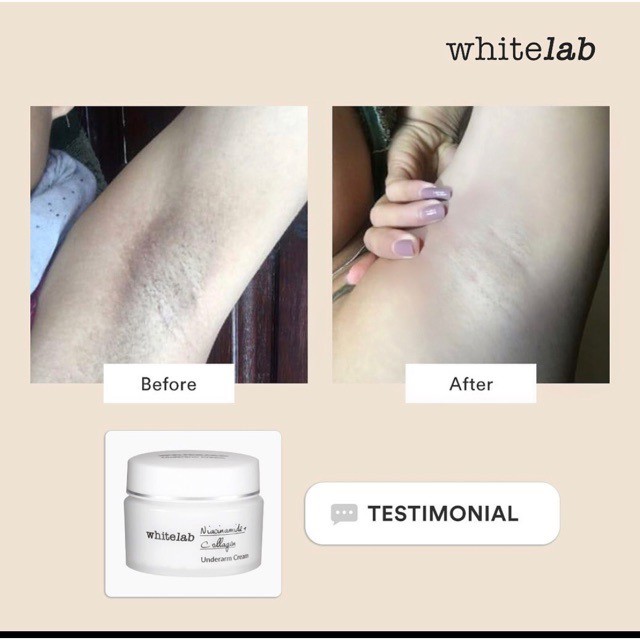 [BPOM] Whitelab Brightening Underarm Cream 20 Gr (Niacinamide + Collagen)