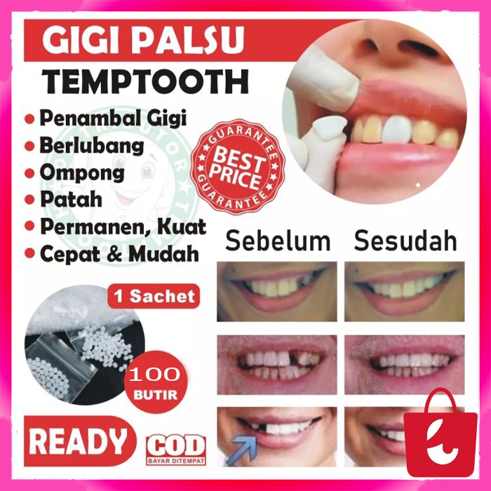 [100 Butir + COD] Penambal Gigi Berlubang Gigi Depan Ompong 100% ORIGINAL Gigi Palsu Original Penutup Gigi