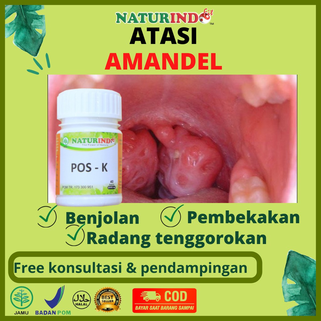 Jual Obat Amandel Radang Tenggorokan Sariawan Ampuh Benjolan Kelenjar