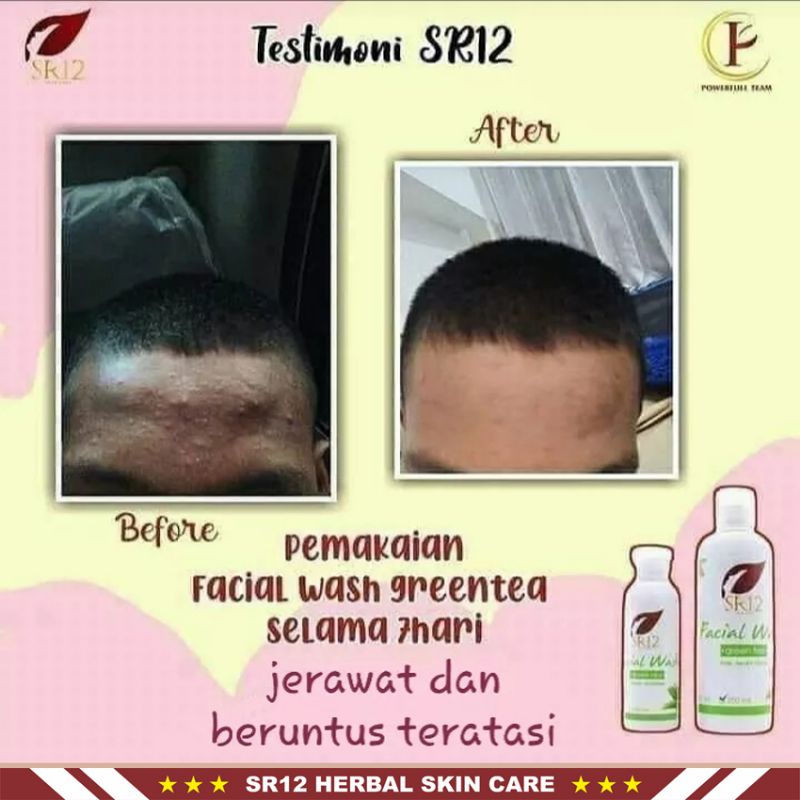 Facial Wash SR12 | Facial Wash Coffee SR12 &amp; Facial Wash Green Tea SR12 | Sabun Wajah SR12 Skincare