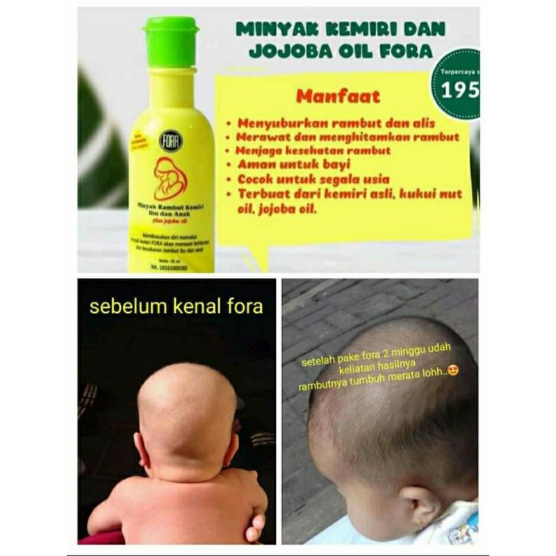 Minyak Kemiri Murni plus Jojoba Oil Penumbuh Rambut dan Alis FORA