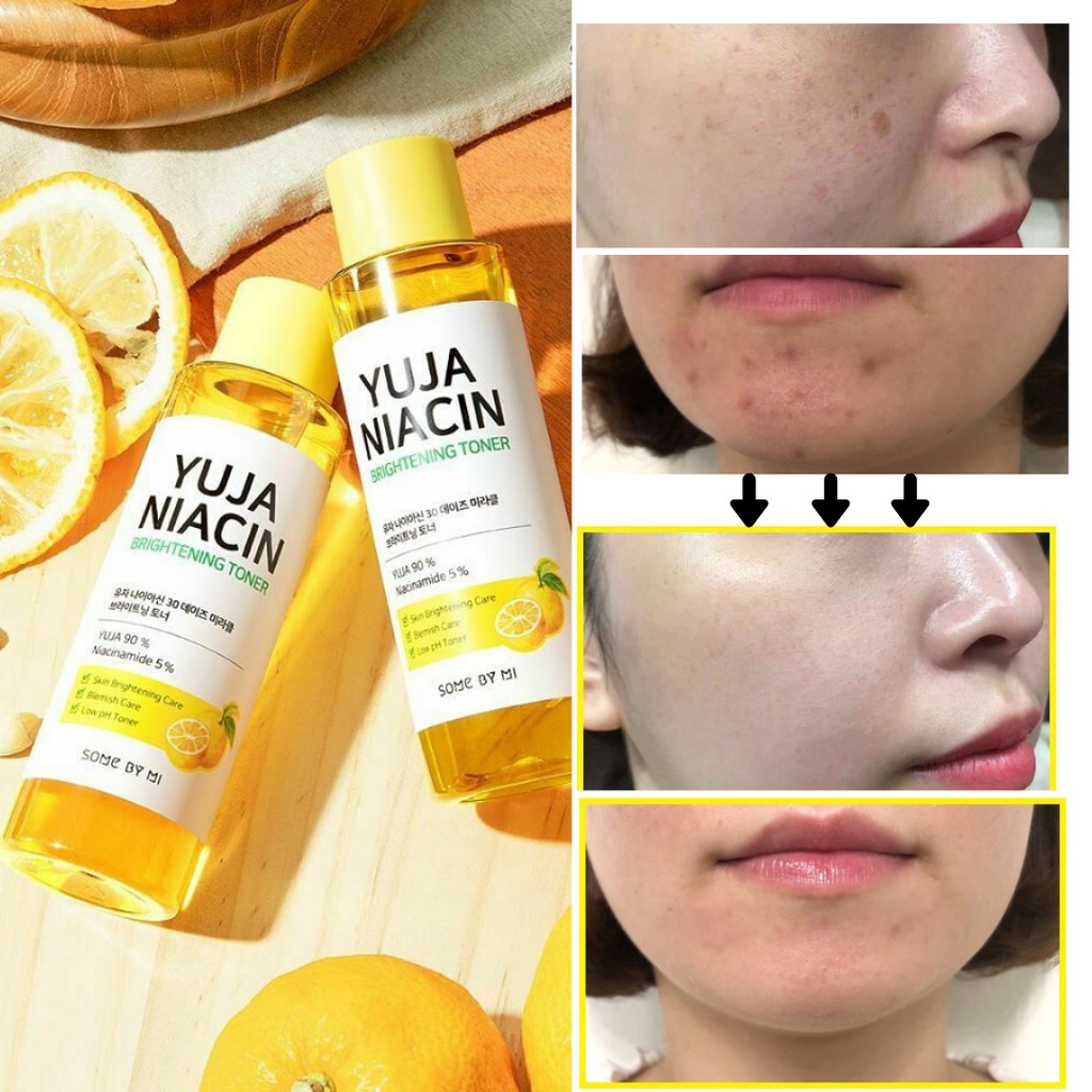 SOMEBYMI YUJA NIACIN 30 DAYS MIRACLE BRIGHTENING TONER 150ML