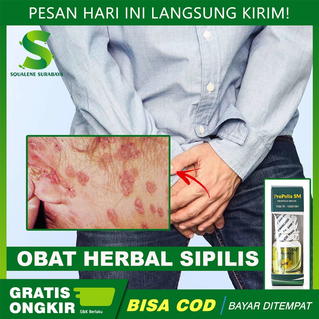 Obat Sifilis - Obat Penyakit Kelamin Pria/Wanita - Raja Singa - Kencing Nanah -  Gonore - Propolis S