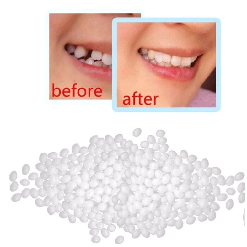 Lem Gigi Palsu / Lem Tambal Gigi Ompong