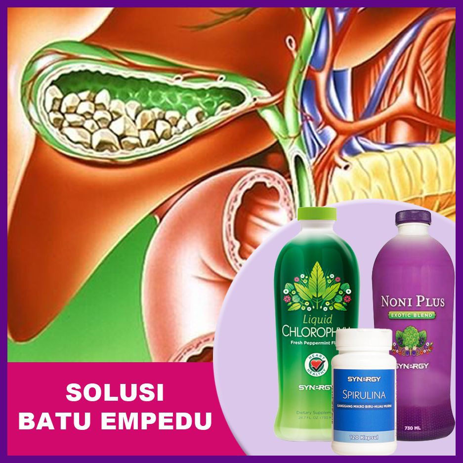 Paket Obat Herbal Batu Empedu & Meningkatkan Kekebalan Tubuh