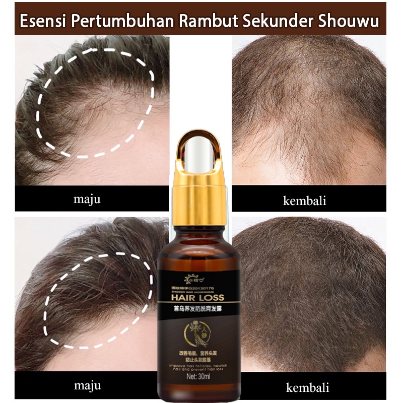 hair tonik 30ml penumbuh rambut/penumbuh rambut botak/serum penumbuh rambut/Memperbaiki folikel rambut/merangsang pertumbuhan rambut/perawatan rambut