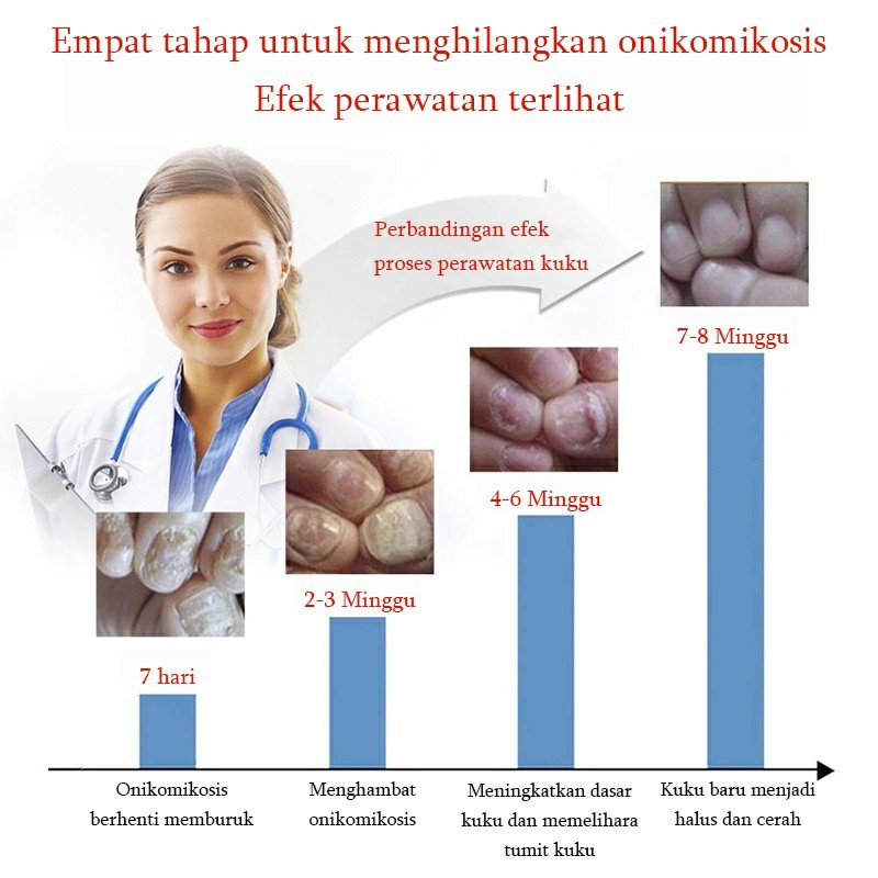 Perawatan kuku Obat jamur kuku 25ml kuku menebal / Atrofi kuku / lapisan kuku / kuku rontok / perubahan warna kuku / kuku bergelombang