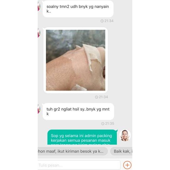 SSP962 peel pengelupasan T20% 30 ml (BADAN) kelupas sel KULIT MATI  KUSAM FLEK PEMUTIH .,.,.,..,