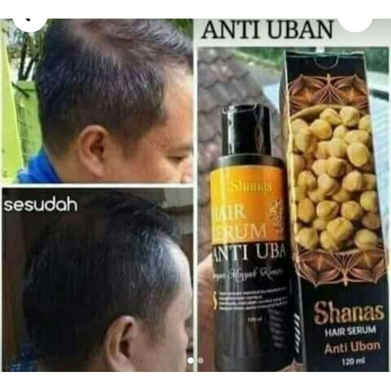 anti uban nasa