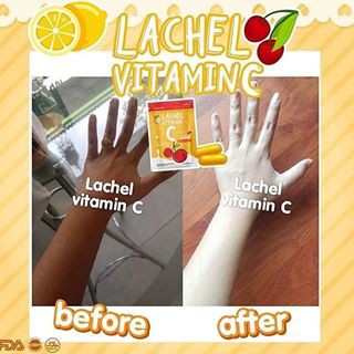 LACHEL VITAMIN C ISI 60 KAPSUL by Skinest Clinic