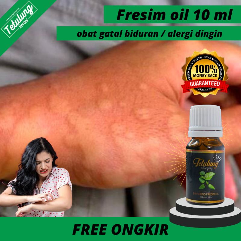 Fresim Oil Binahong , Obat Gatal Alergi Dingin Biduran Ampuh - Obat Oles Biduran Alergi Dingin - Sal