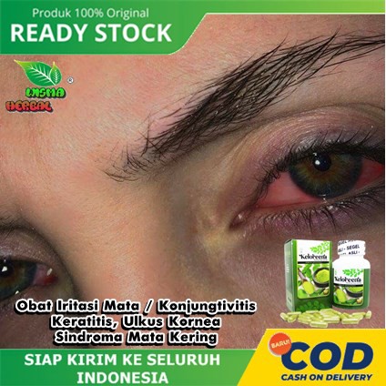 Obat Iritasi Mata / Konjungtivitis, Keratitis, Ulkus Kornea, Sindroma Mata Kering - Keloreena Herbal