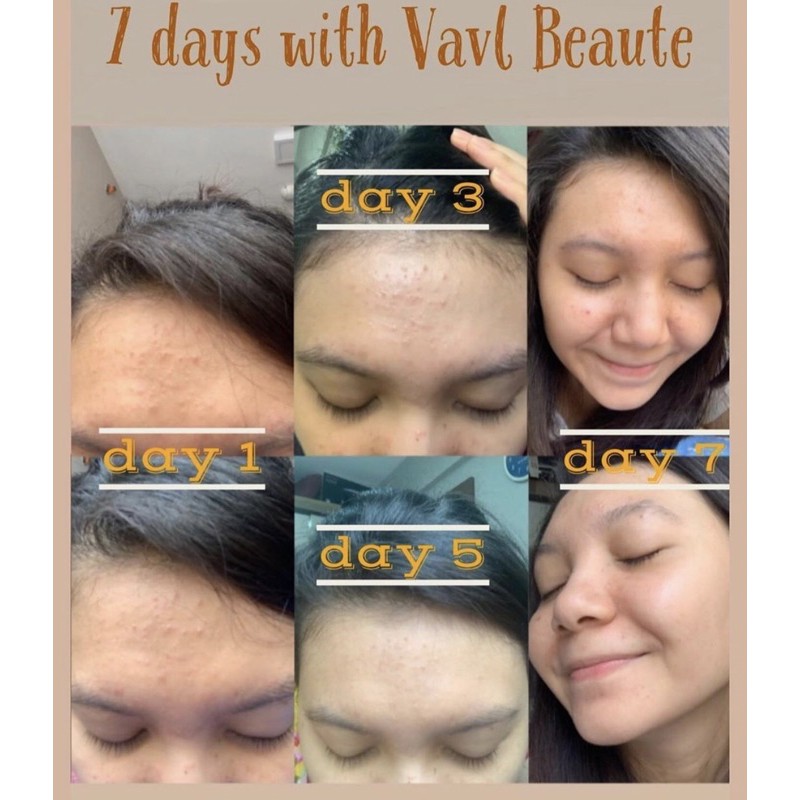 VAVL BEAUTY WATER / VIGHTNE BLEMISH SERUM /FACIAL CLEANSER / SUNSCREEN / BODY SERUM / PEELING SPARY