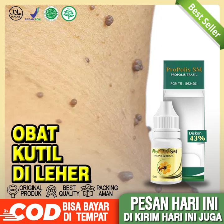 Obat Kutil Di Leher, Penghilang Kutil Di Leher, Kutil Papiloma Di leher, Perontok Kutil Di Leher