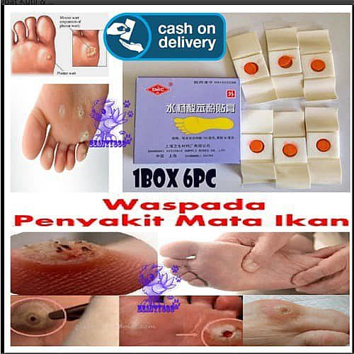 Plester Obat Kutil & Mata Ikan Penutup Kutil Koyo Kutil ji yan gao Menghilangkan di Seluruh Area Sam-4
