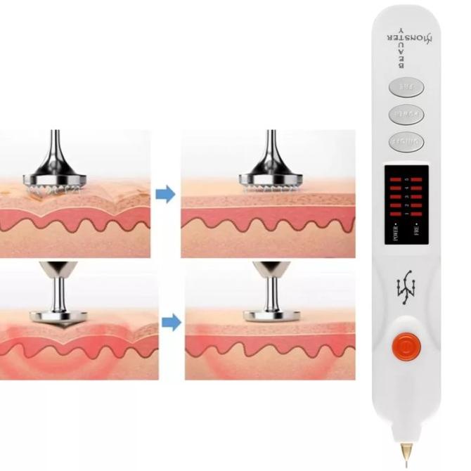 Beauty Monster/ Plasma Pen