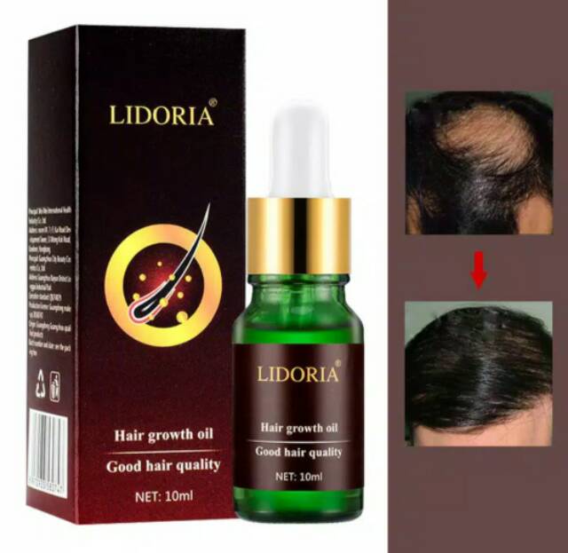 Herbal penyubur rambut atasi kebotakan