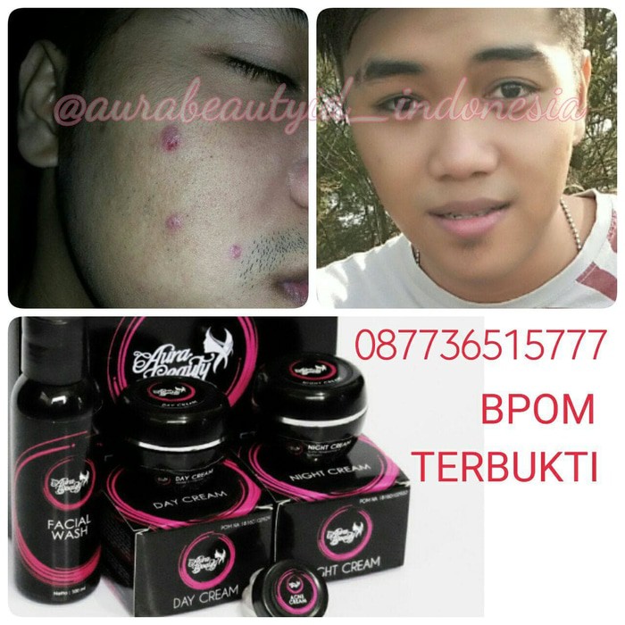 Perawatan Tubuh - Kecantikan - Perawatan Kulit Aura Beauty Acne Complete Sekaligus Pencerah Wajah