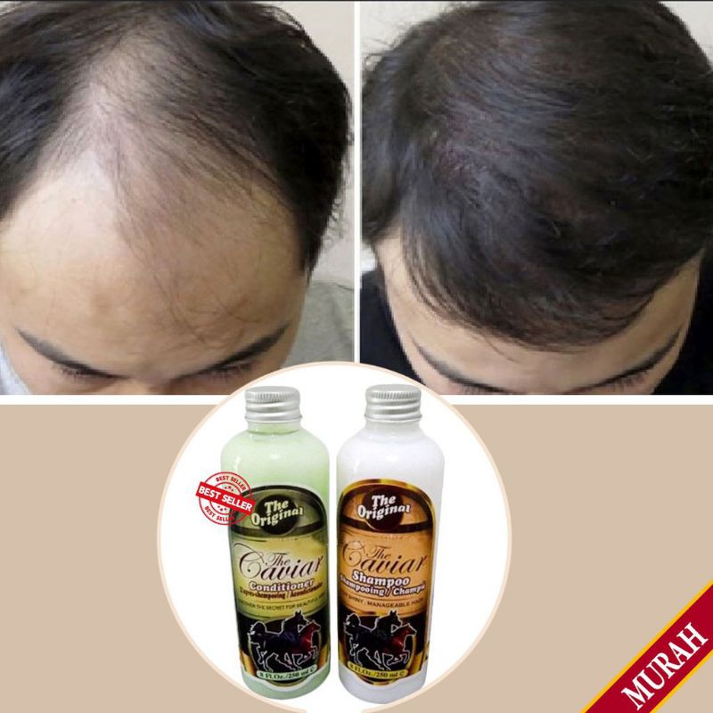 PENUMBUH RAMBUT PALING AMPUH ANTI RONTOK BOTAK PAKET THE CAVIAR 2 in 1 SHAMPOO + CONDITIONER BPOM