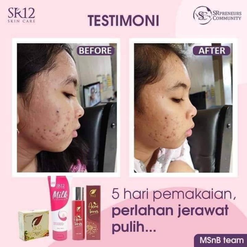 SR12 PAKET DEEP CLEANSING / DOUBLE CLEANSING SR12 / PEMBERSIH KULIT WAJAH MAXIMAL