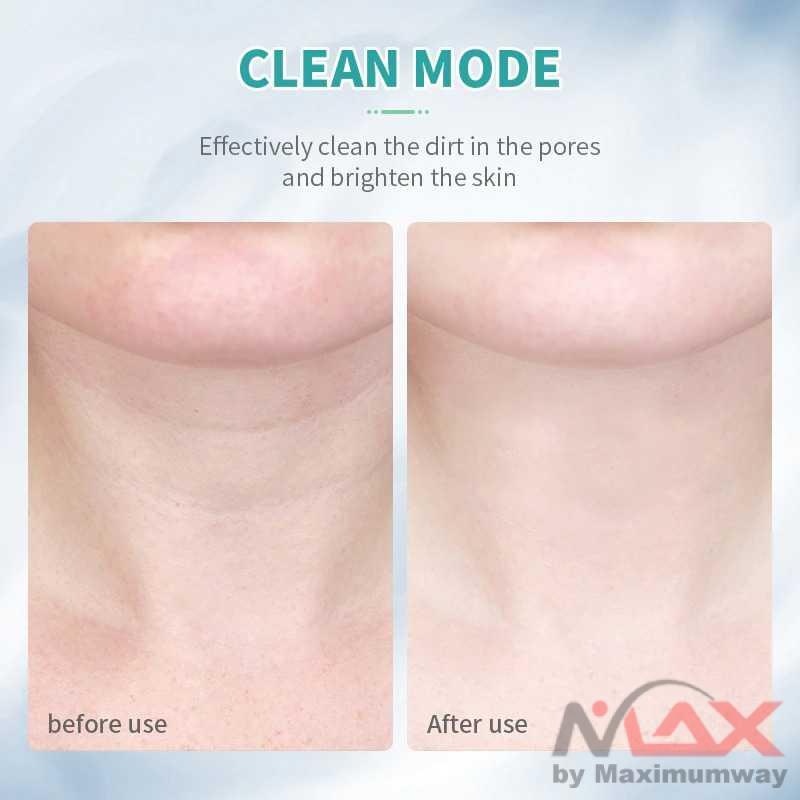 Alat Setrika Wajah leher Terapi Kecantikan LED Photon Pemijat Perawatan Kulit Anti Anging keriput ANLAN Neck Face Beauty Device 3 Colors LED Photon Therapy Skin Tighten Reduce Double Chin Anti Wrinkle Remove Skin Care Tools-2