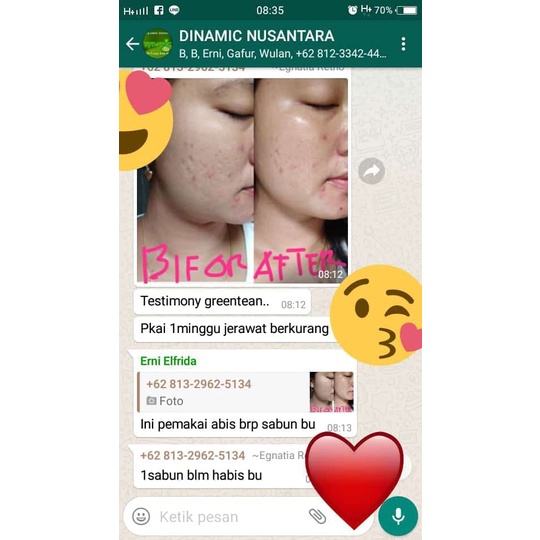 sabun muka glowing / Sabun Herbal Plus Asli Original BPOM PT.Cressindo Kusuma / sabun muka flek hita