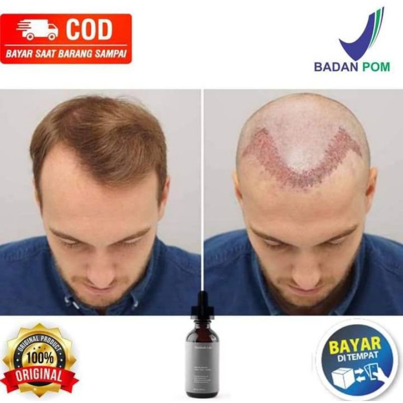 PENUMBUH RAMBUT,BREWOK,KUMIS,BULU MATA DAN ALIS PRIA DAN WANITA HERBAL 100% ALAMI DAN HALAL