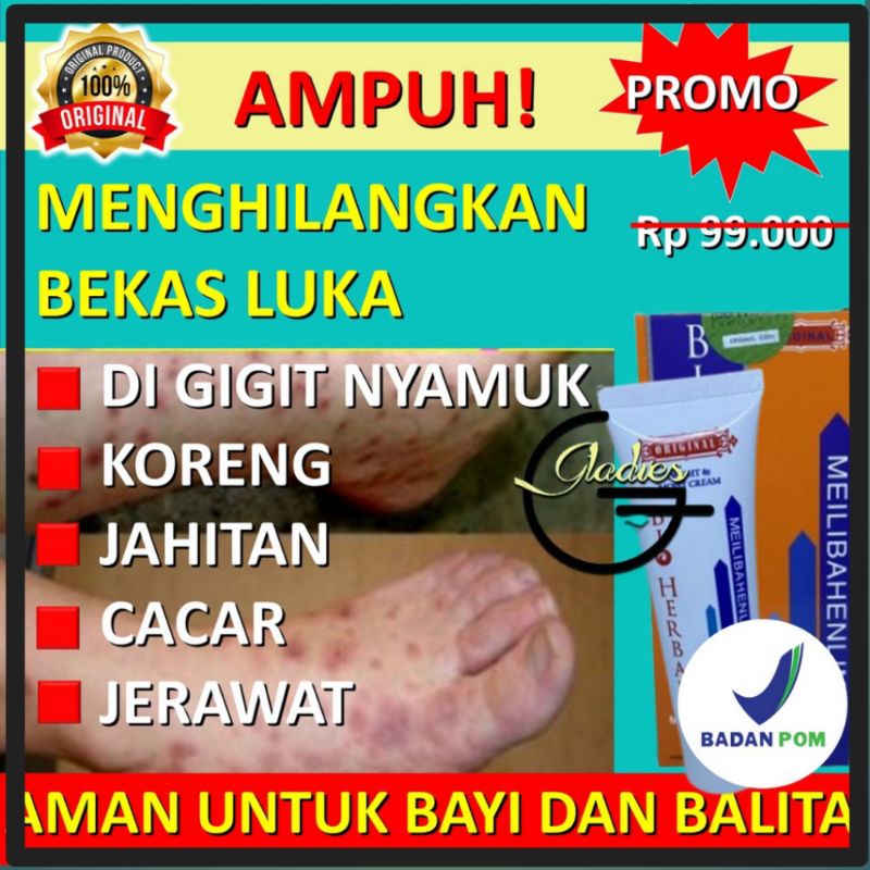 ORI Obat Penghilang Bekas Luka Menghilangkan Bekas Luka Lama Hitam Koreng Ampuh Di Wajah Di Kaki BPO