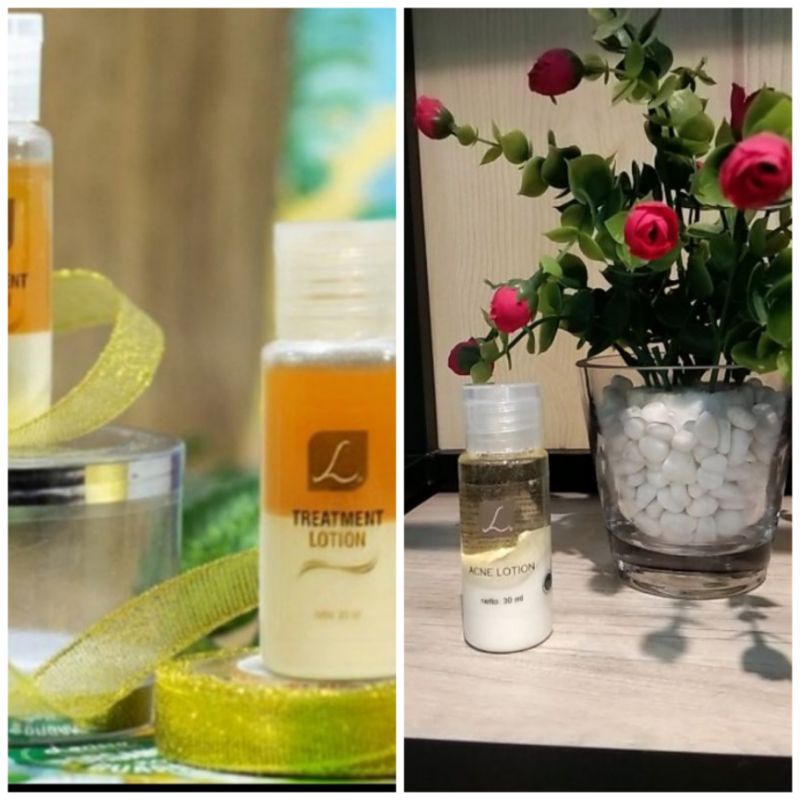 ACNE LOTION & TREATMENT LOTION #Larissa