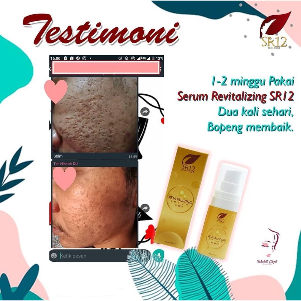 Revitalizing Serum SR12 - Serum Bopeng - Serum Pengecil PoriPori Wajah Ampuh - Serum Pengecil Pori