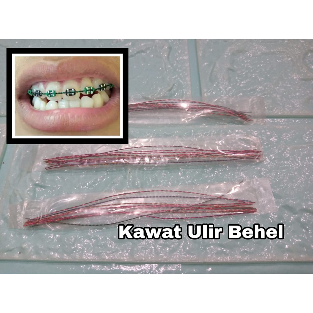 Kawat Ulir Behel Kawat Behel Ulir Dental Wire