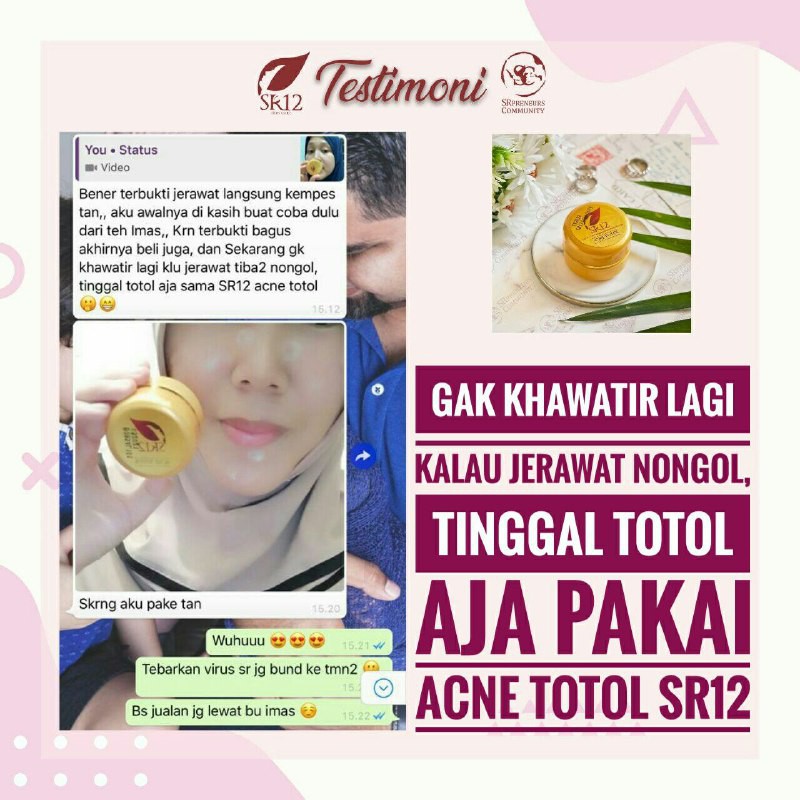 KRIM JERAWAT TOTOL SR12 BPOM AMAN AMPUH MENGEMPESKAN JERAWAT CREAM TUMPAS JERAWAT PERAWATAN JERAWAT