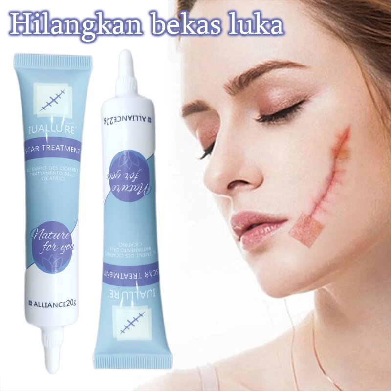 Krim Cream Salep penghilang luka bekas Menghilangkan stretch mark 20G Penghilang bekas luka yang ampuh Memperbaiki bekas luka bakar Bekas Jerawat Bekas luka lama Benjolan dan jerawat