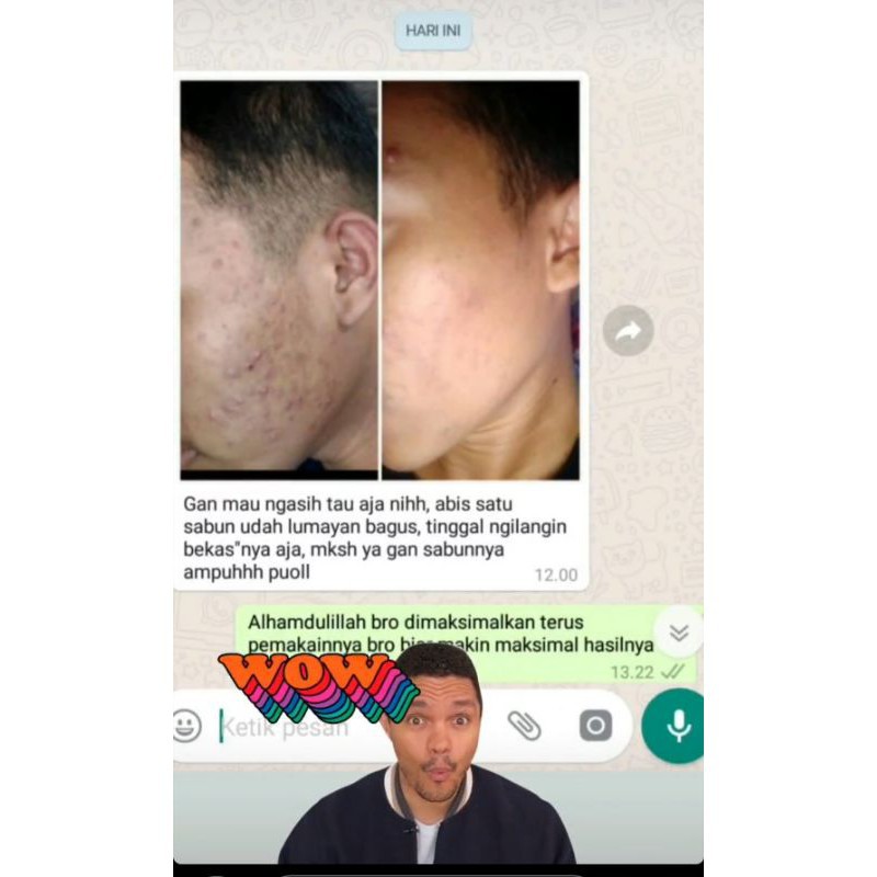 Skincare Perawatan Pria Clorismen Penghilang Bekas Jerawat Dan Bopeng Scar SC Serum Cloris Men C9