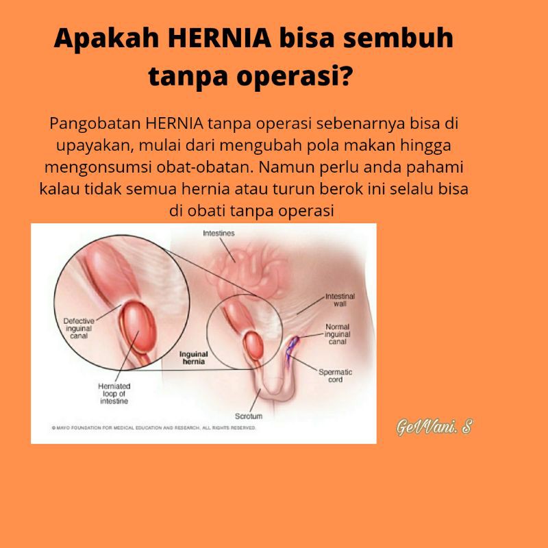 Celana Hernia Cowo Laki laki  Anak Dewasa Murah Berkualitas