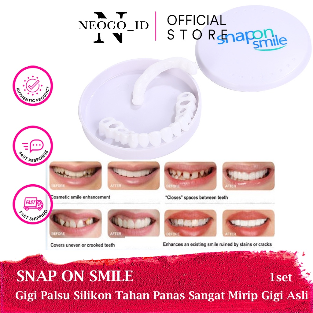 Snap On Smile 100% Original Authentic / Gigi Palsu Snapon Smile 1 Set Veneer Gigi palsu Perawatan Gi