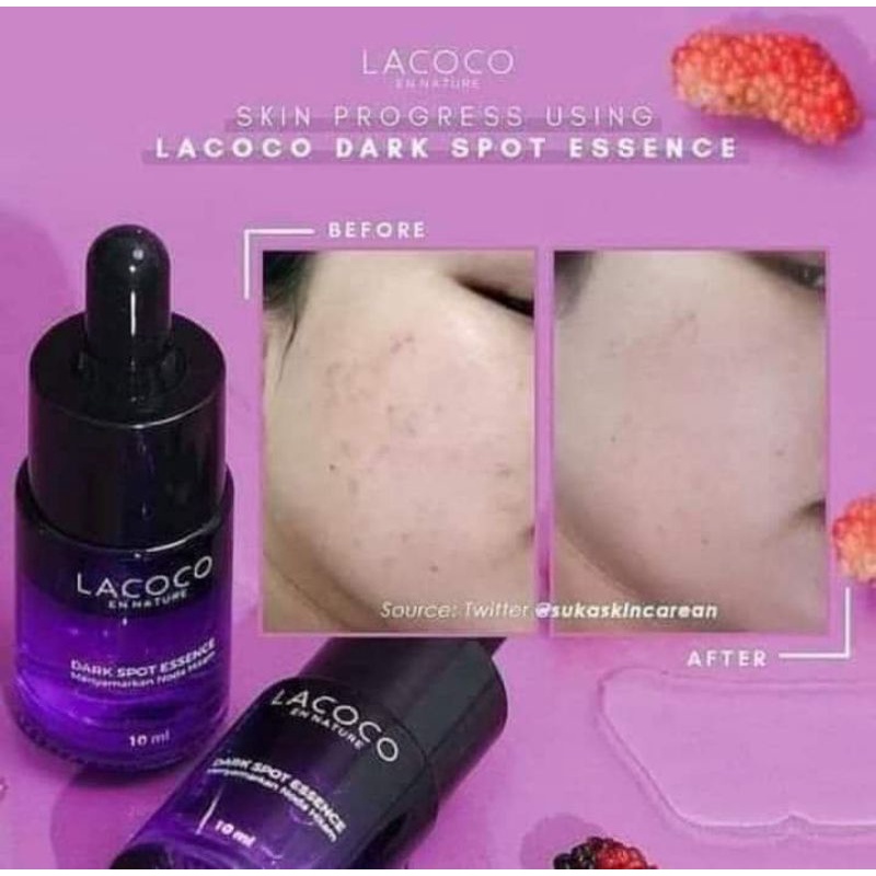 SERUM JERAWAT FLEK ORIGINAL NASA BPOM / LACOCO DARKSPOT ESSENCE
