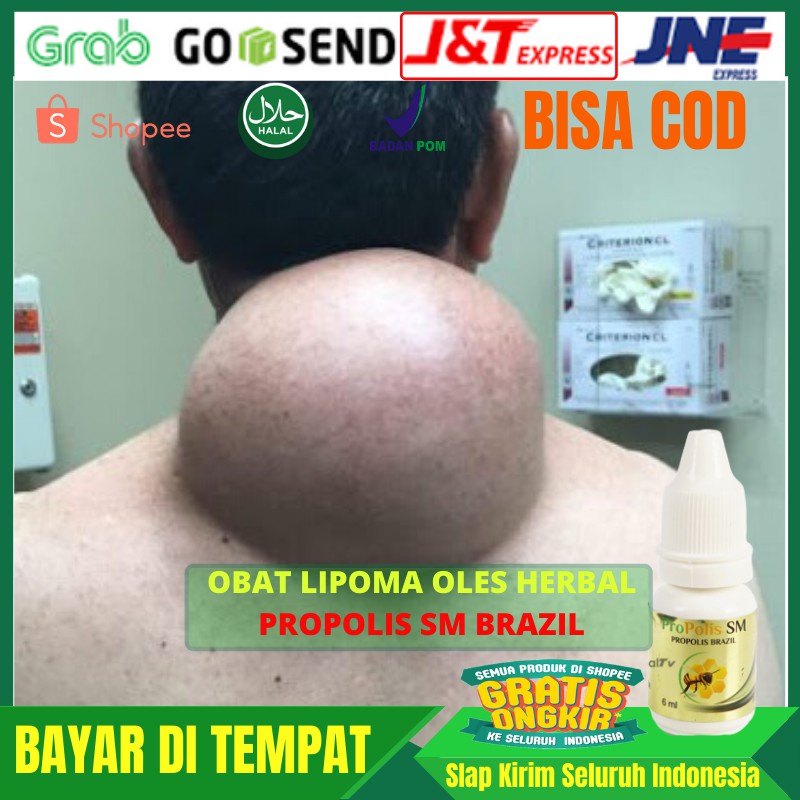 Obat Lipoma Oles Herbal - PROPOLIS SM BRAZILLIAN ORIGINAL
