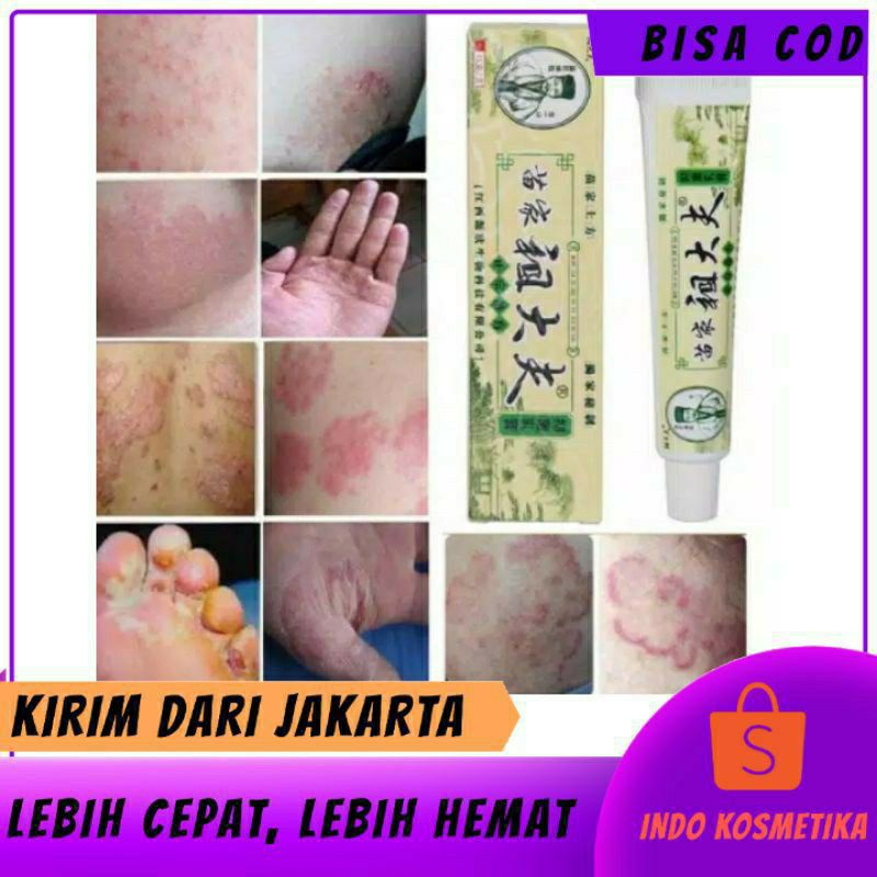 Obat Salep Kulit Gatal Kurap Jamur Bakteri ZUDAIFU Herbal Cina - Free Sachet