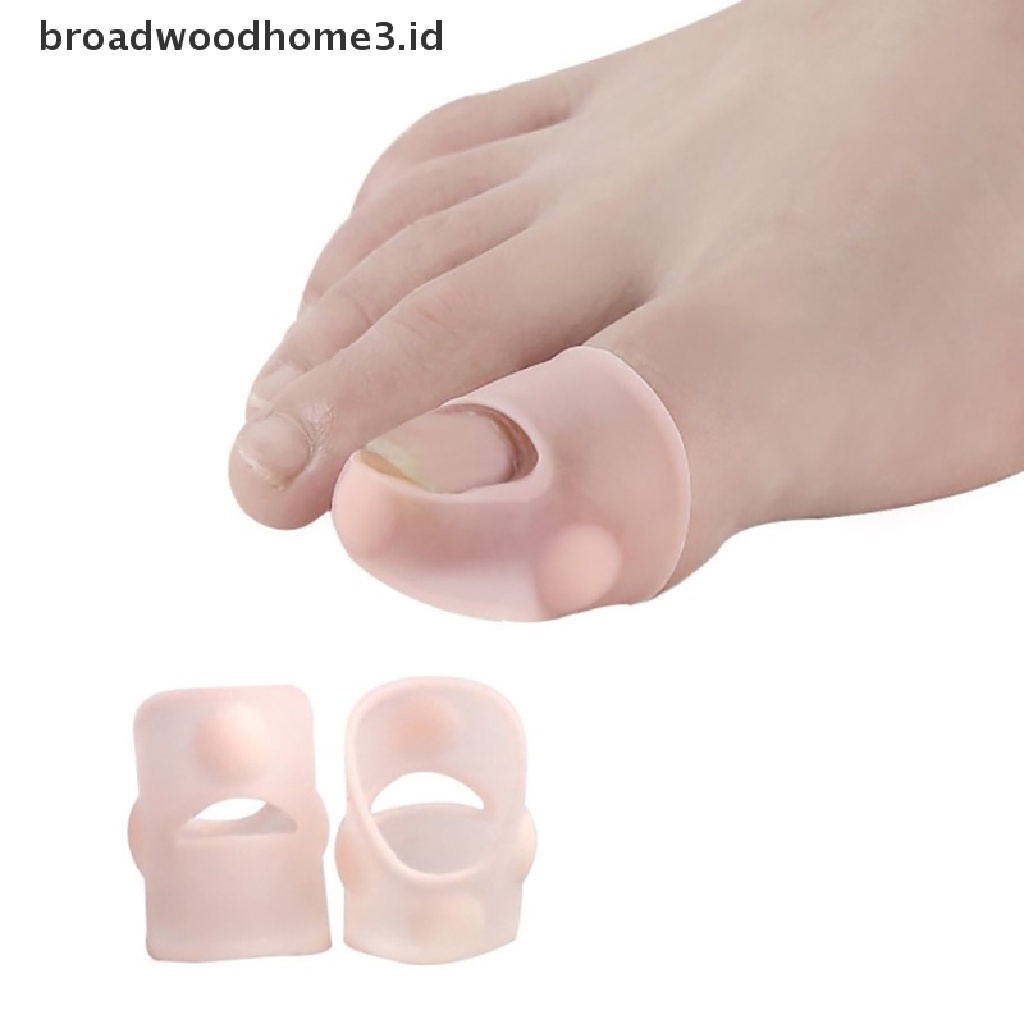 1 Pasang Alat Koreksi Kuku Kaki Ingrown Bahan Silikon