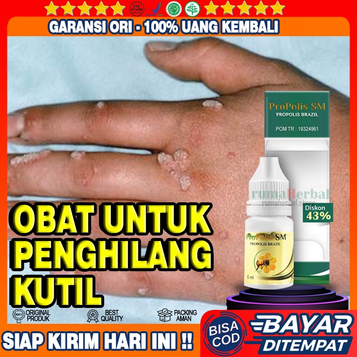 Obat Kutil, Kutil Kelamin Pria, Kutil Papiloma, Kutil Di Leher, Kutil Kelamin Wanita, kutil Di Mata