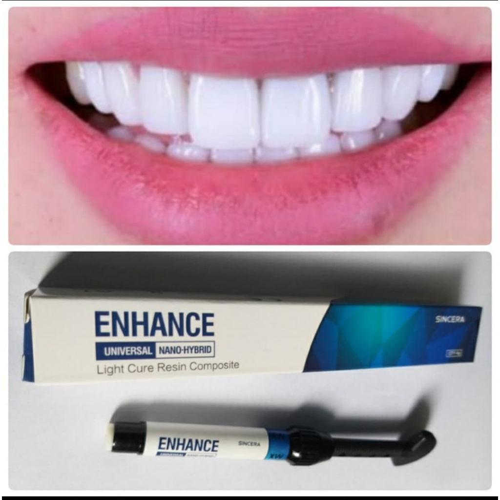 COMPOSITE SINCERA / LEM TAMBAL GIGI / LEM VENEER ATAU GIGI KELINCI