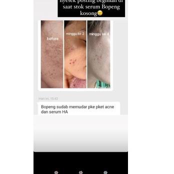 HA SERUM DAVIENA|SERUM BOPENG|DAVINA|DAVIENA SKINCARE|DAVIENA|SERUM HA DAVIENA