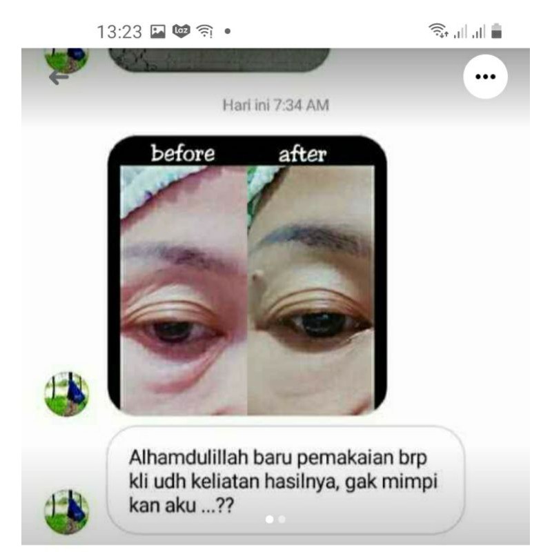 ampuh mata panda dan kantung mata