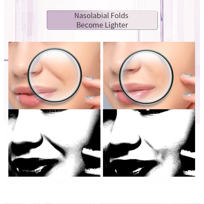 ANLAN KC-6100 Face Massager Alat Pijat Perawatan Kulit Wajah EMS RF- ALSPY01-04 - Pink