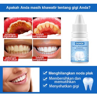 [COD]Pemutih Gigi Kuning Kerak Penghilang Karang Permanen Original Ampuh Teeth Whitening Menghapuskan plak gigi dan noda asap menghapuskan bau mulut Perawatan Mulut Menghilangkan Plak Serum Efektif Untuk Pemutihan Gigi 4.8