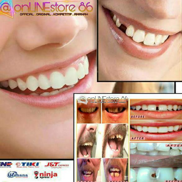 ~ CUCI GUDANG PEMUTIH GIGI BPOM~ GIGI PALSU TEMPTOOTH TEMPORARY TOOTH | LEM TAMBAL GIGI INSTAN KUAT